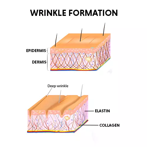 Skin Tightening Treatment in Bangalore