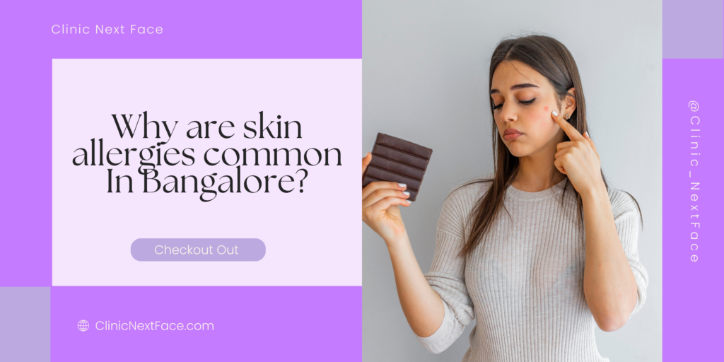 Skin allergies in bangalore