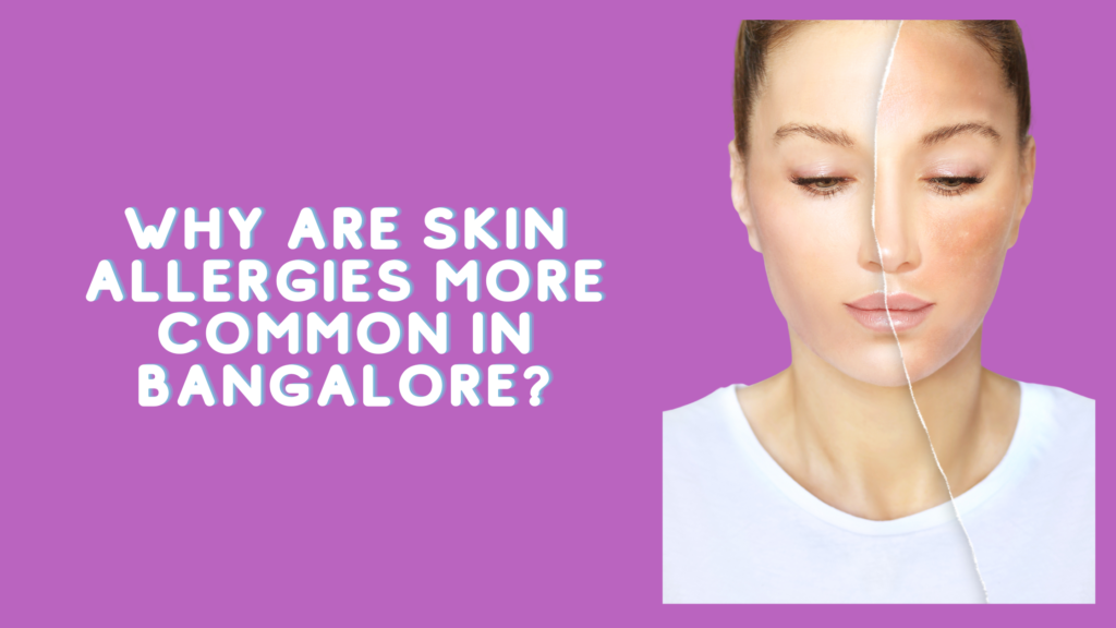 Why Are Skin Allergies More Common In Bangalore? Clinic Next Face