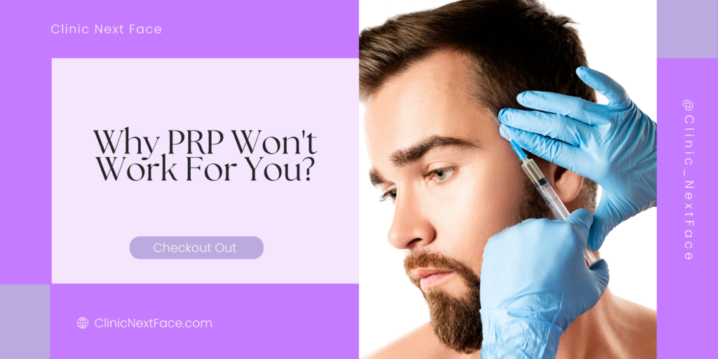 PRP-Not-Working-For-Hair-loss