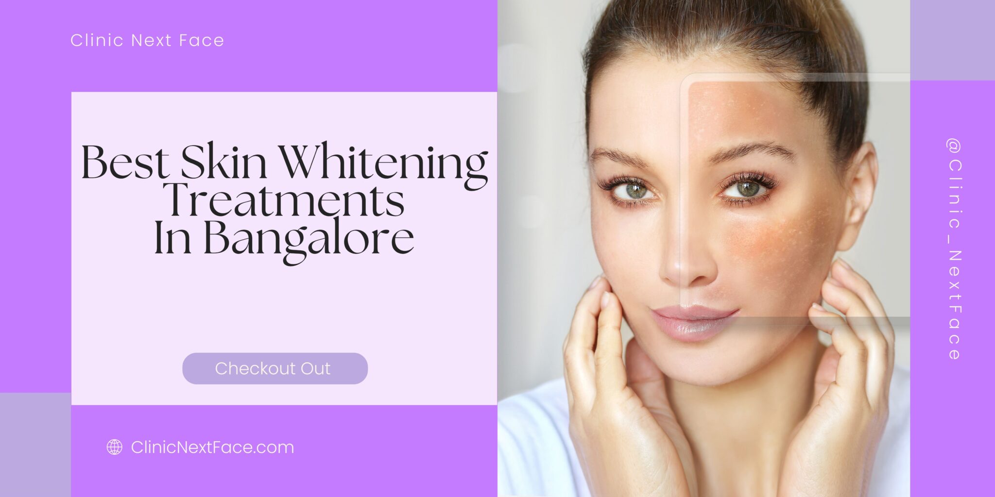 Best Skin Whitening Treatments Available In Bangalore CNF