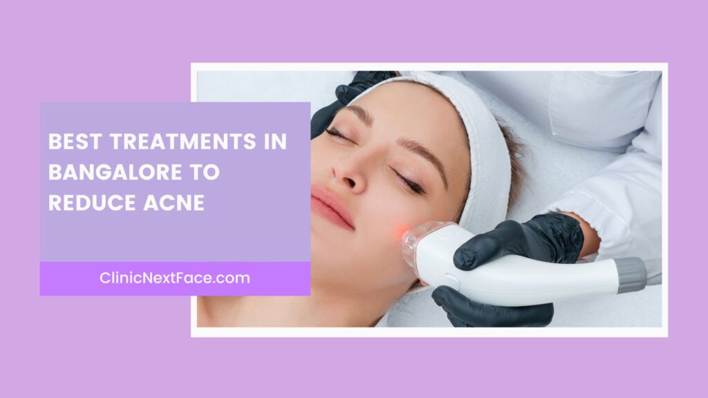 Best Treatments in Bangalore to reduce Acne.