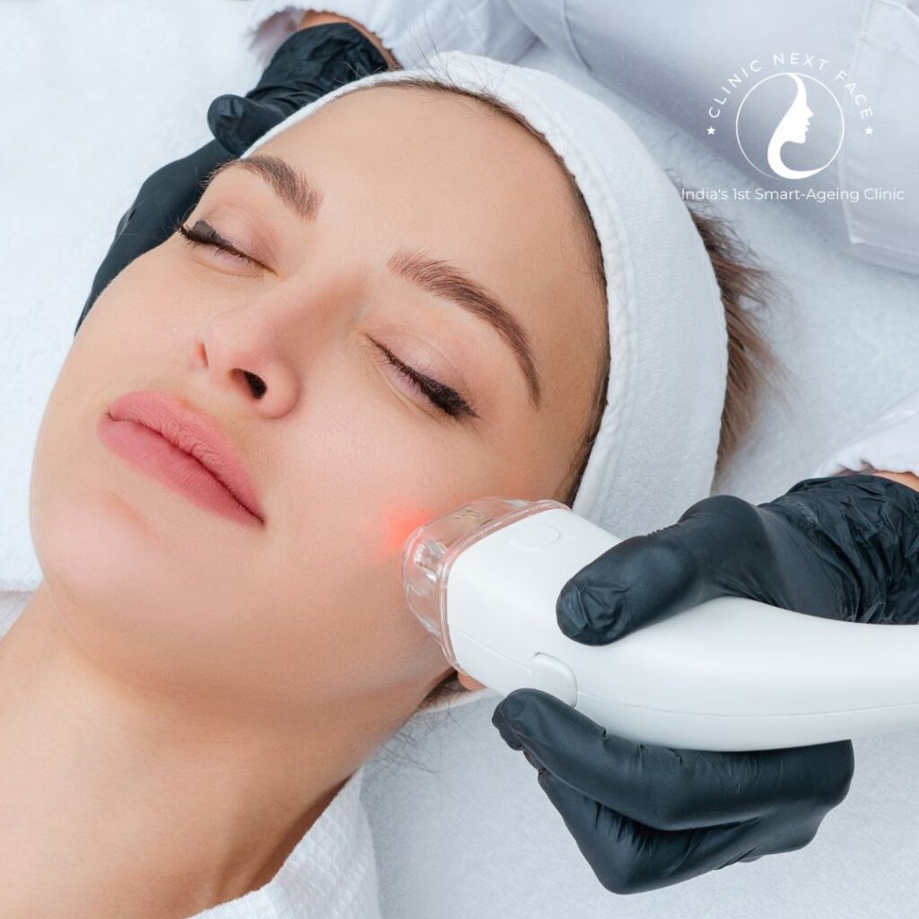 Laser Treatment in Bangalore - Clinic Next Face