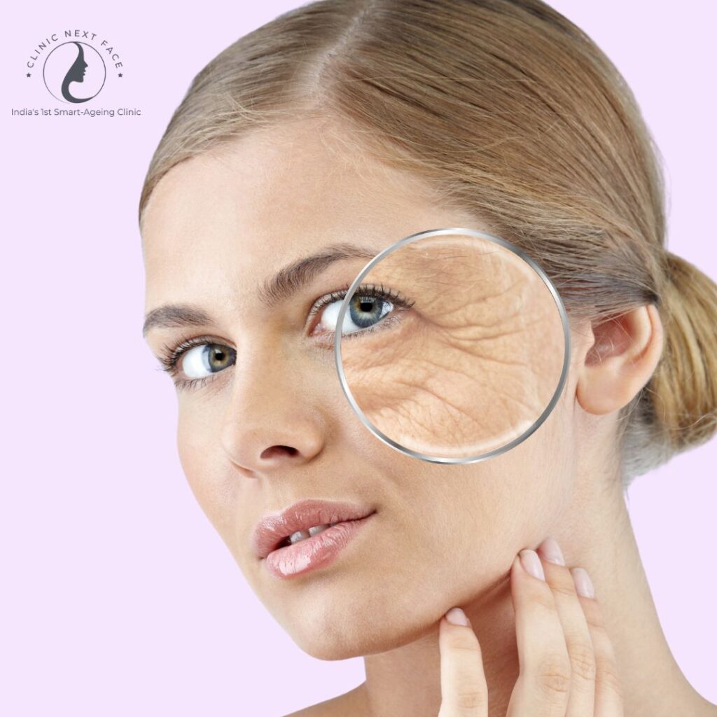 STATIC WRINKLE REMOVAL IN BANGALORE