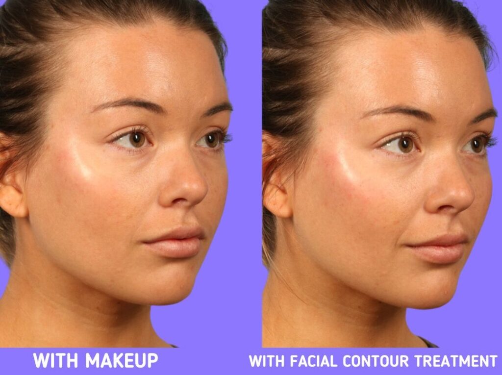 How to Contour, Cheekbone-lift instead of Creating a Beard