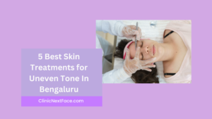 5 best skin treatment for skin in bangalore
