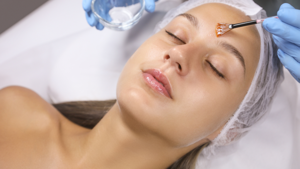 Chemical Peel treatemnt in jp nagar