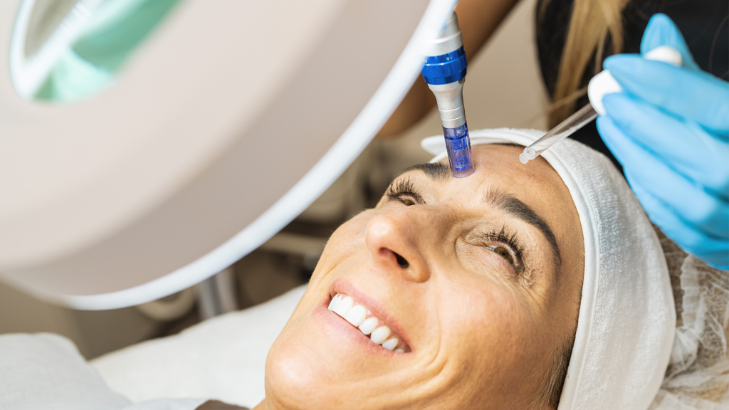 Microneedling therapy with vitamin infusion