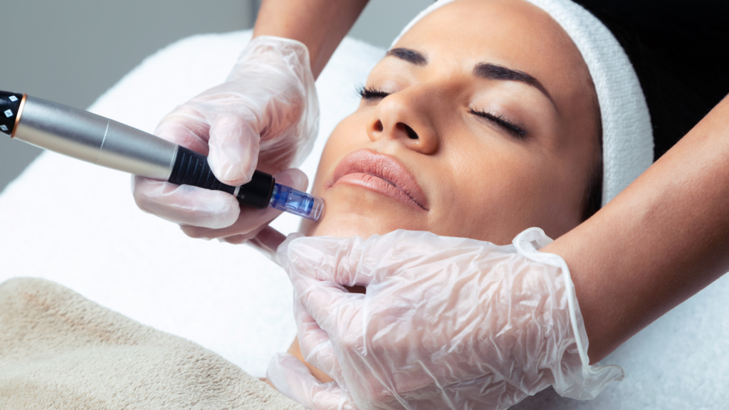best Microneedling treatment in bangalore