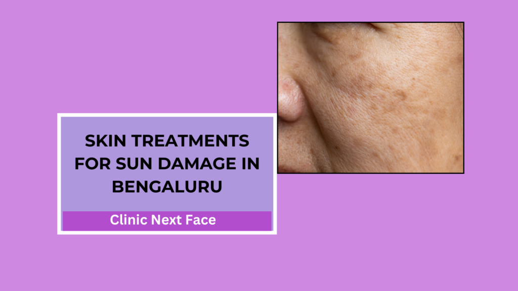 Skin Treatments For Sun Damage in Bengaluru