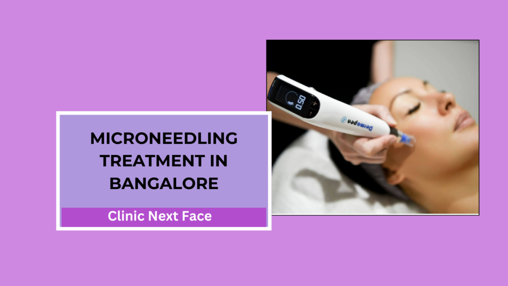 Best microneedling treatment in bangalore