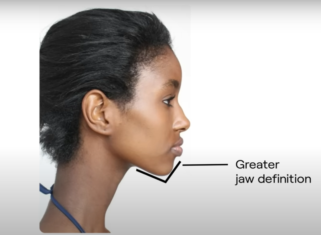 greater jaw line 