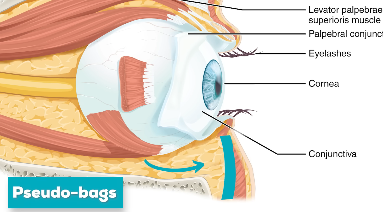 5 Best Ways To Treat Wrinkles Around Eyes (Under Eye Ageing)