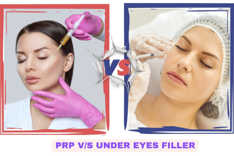 PRP vs Under Eyes Filler