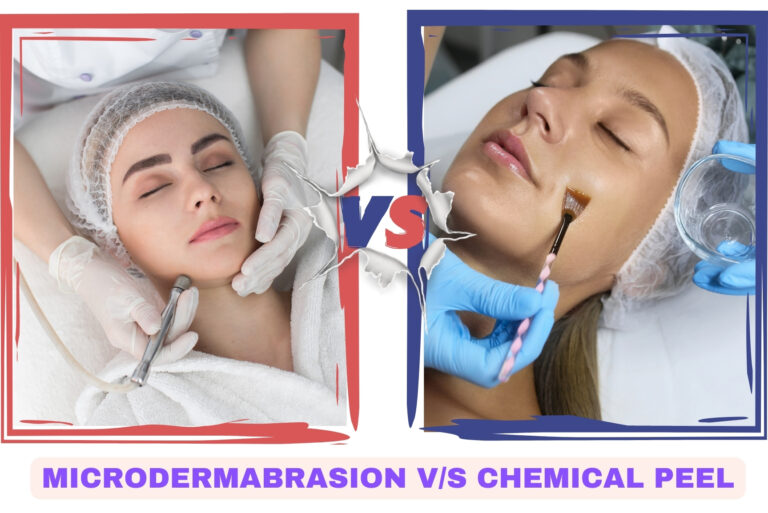 microdermabrasion v/s chemical peel