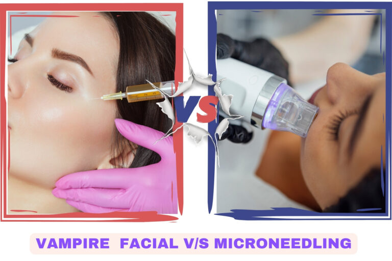 vampire facial v/s microneedling