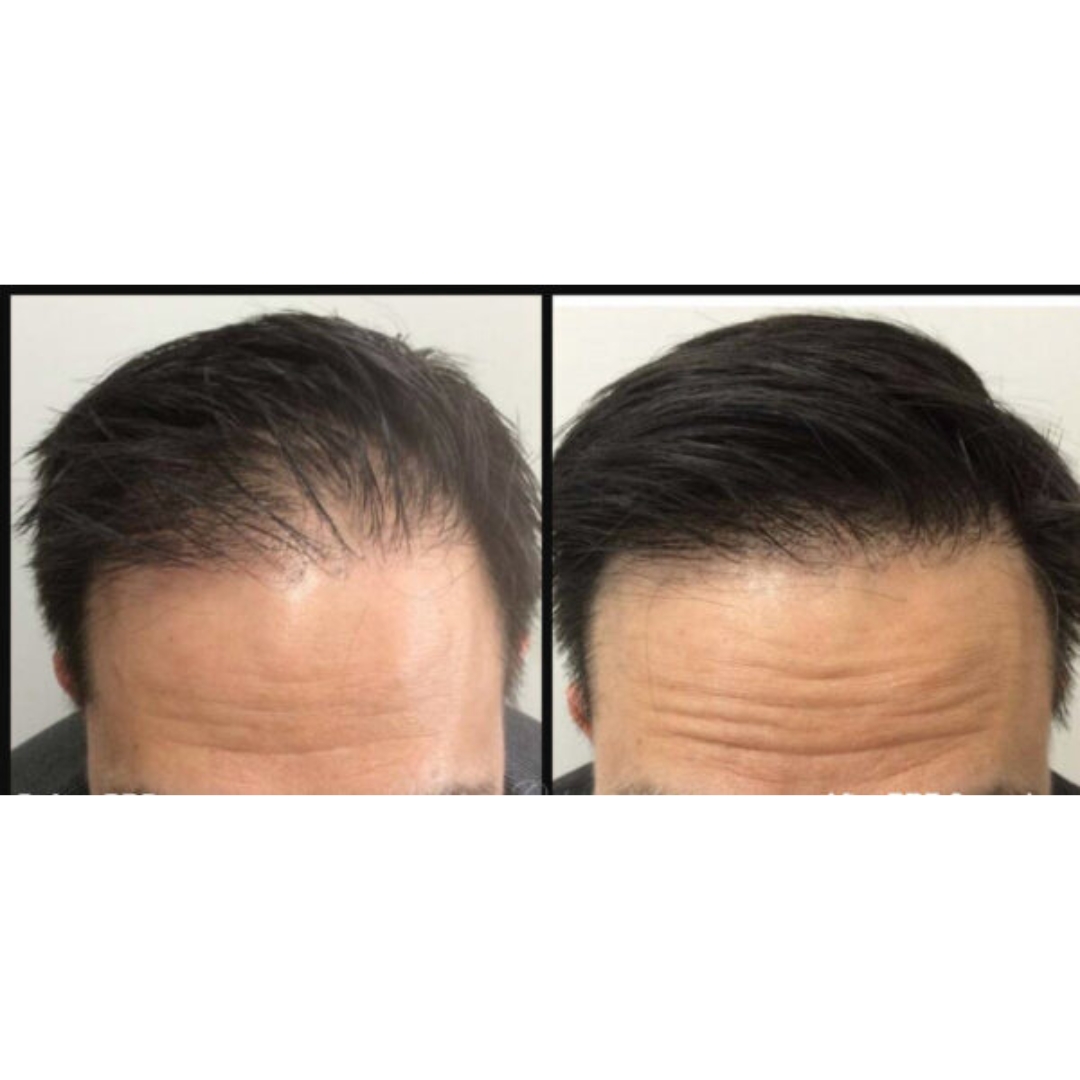 hair loss vs hair growth 1