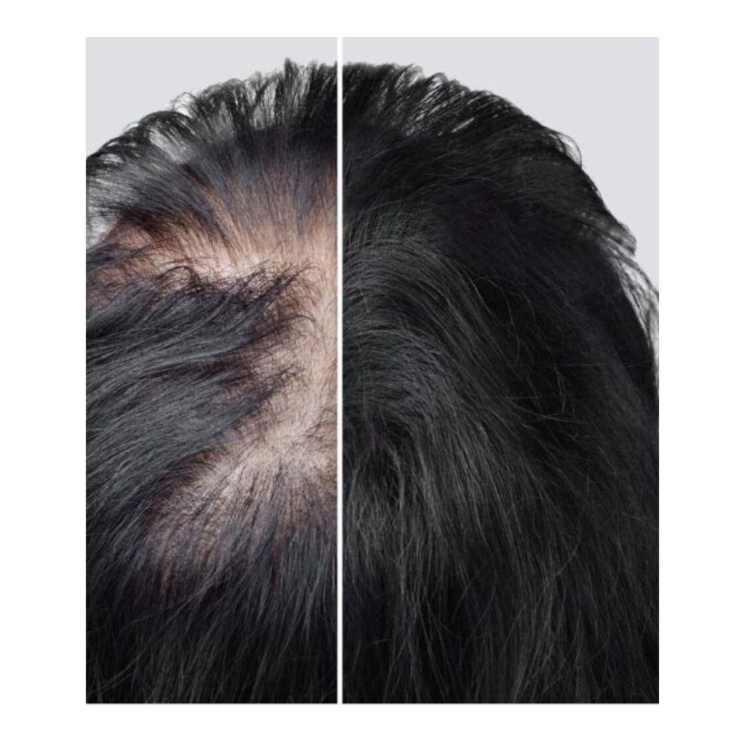 hair loss vs hair growth 3