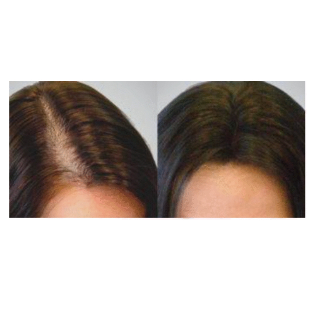 hair loss vs hair growth 4