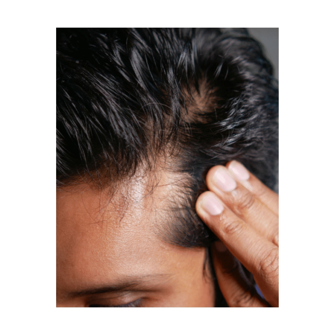 hair loss vs hair growth 6