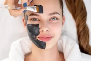 carbon facial