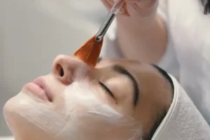 chemical peel 1