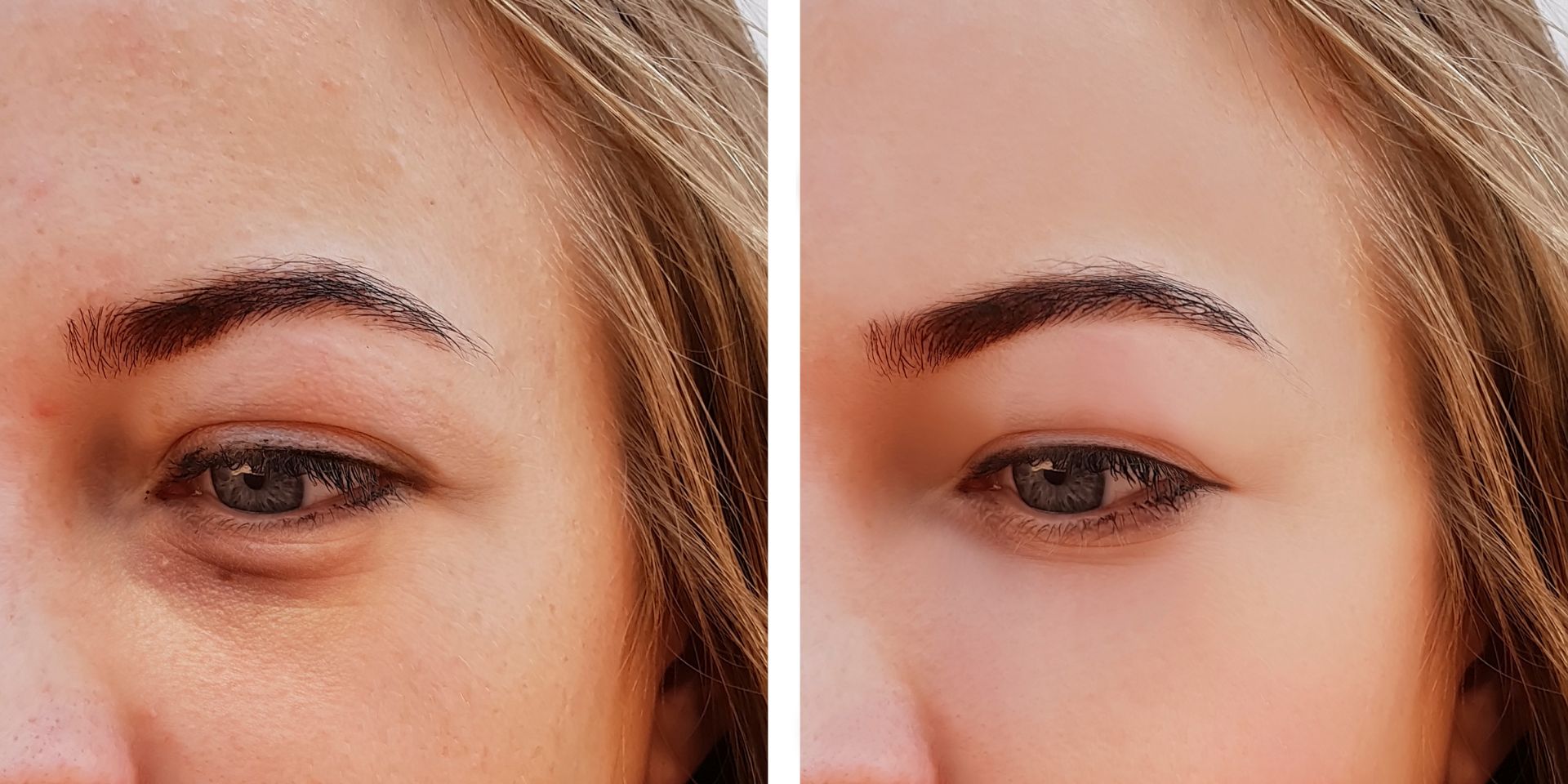 Untitled design 2024 03 25T172346.905