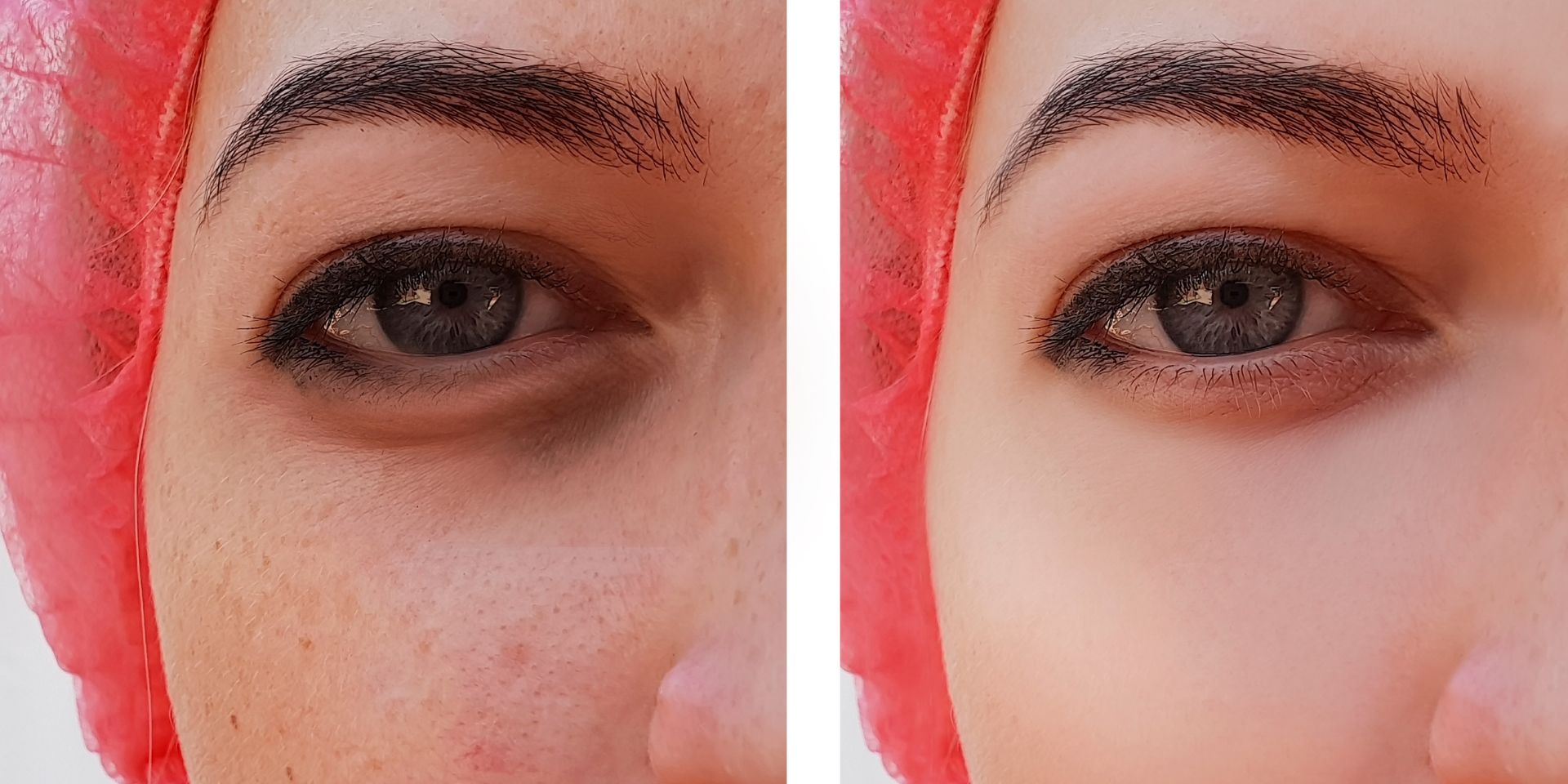 Untitled design 2024 03 25T172421.900