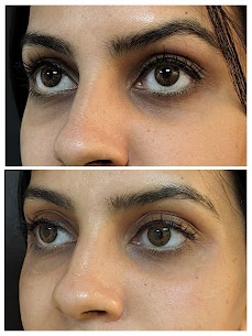 Dark Circles