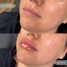 Lip Hydration pic 6
