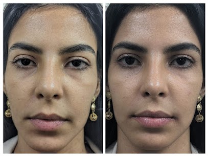 Lip & Under Eye Filler