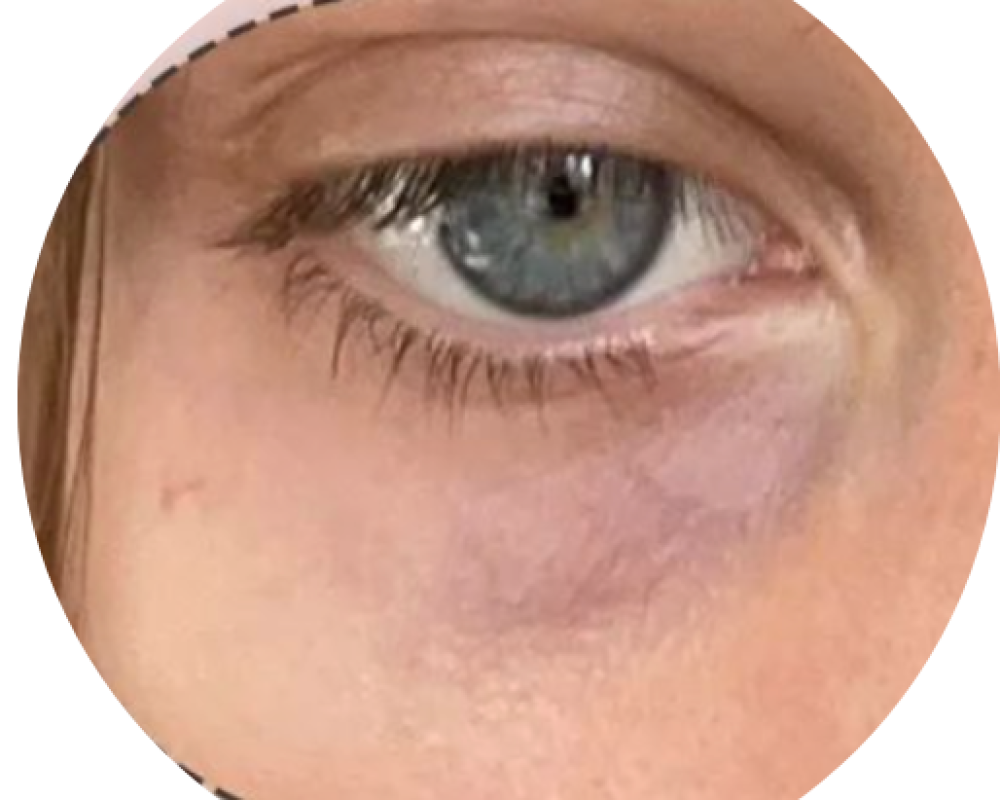 Dark Pigment (1)