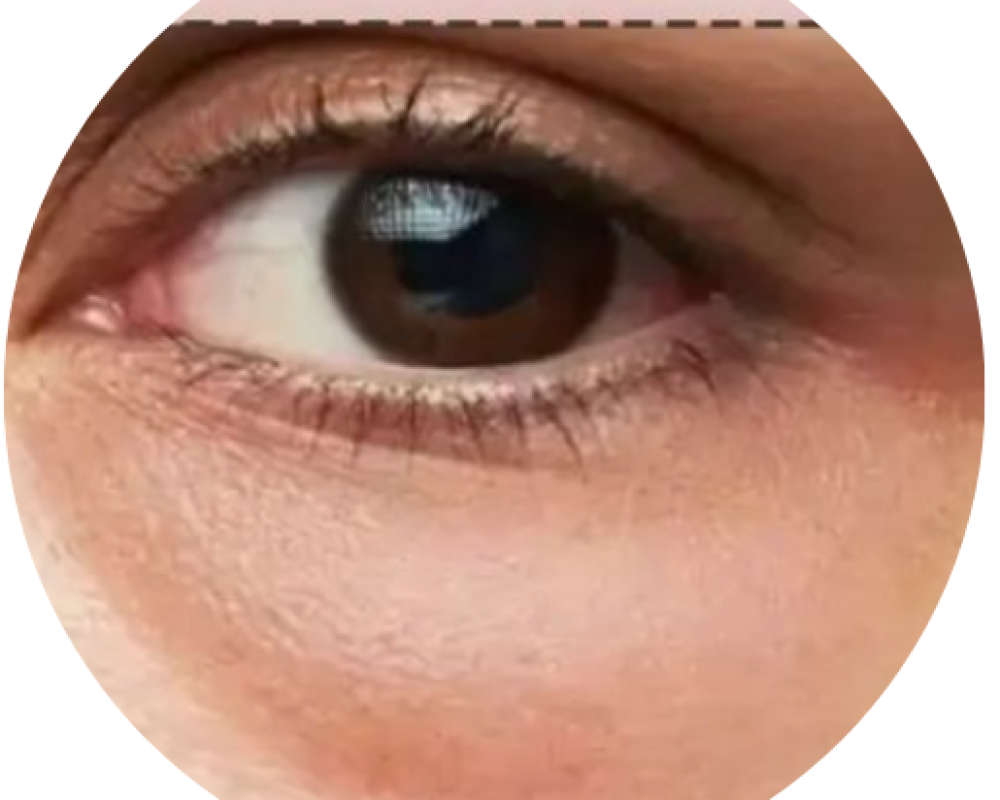 Dark Pigment (2)