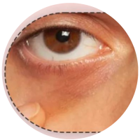 Dark Pigment (3)