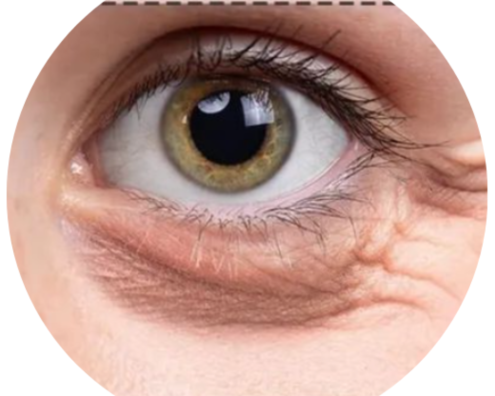 Dark Pigment (4)