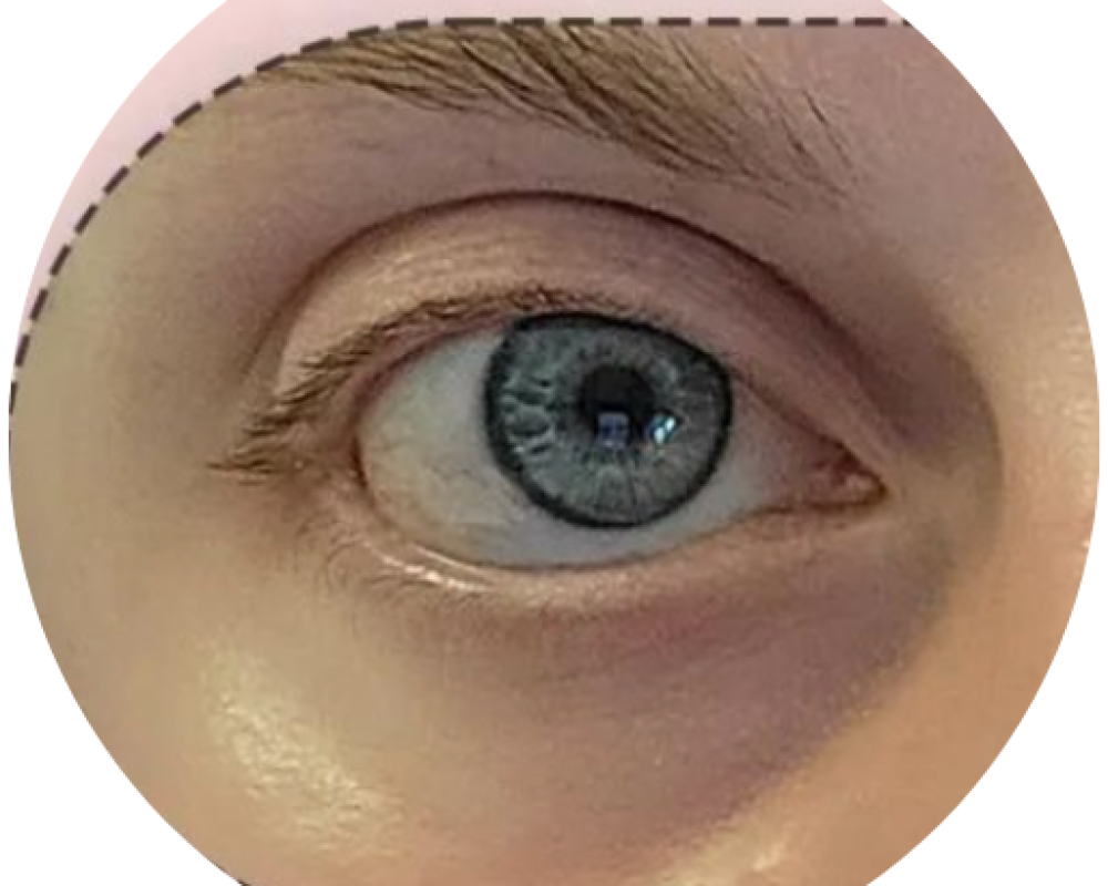 Dark Pigment (5)
